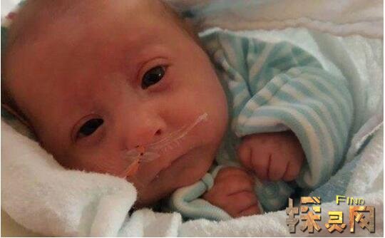 世界上最小的婴儿只有24cm长,阿米利娅泰勒现状