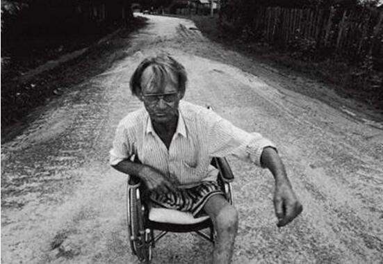 切尔诺贝利核泄漏事故惨出变异人20万清理人惨状横生2