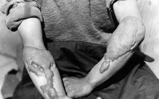 日本核辐射下的变异人