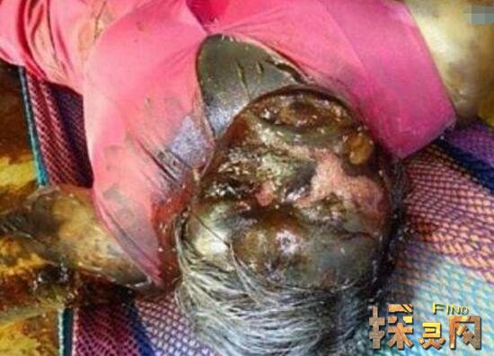 巨人观为死后3天以上;全身软组织腐烂,崩溃,表明已死亡15天左右,等等