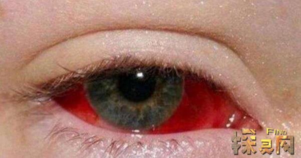 世上真的有阴阳眼吗阴阳眼可看见鬼神胆小勿入图片2