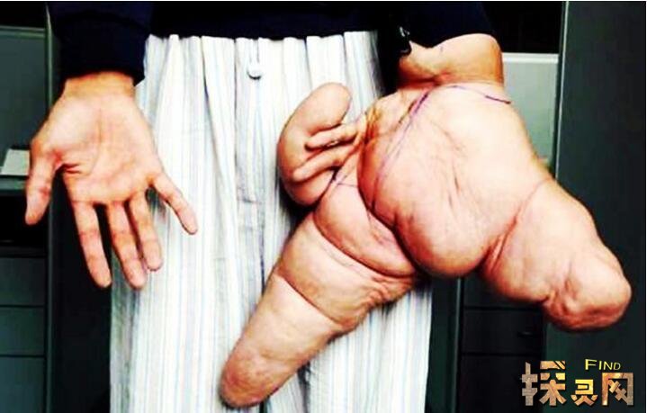 世界上恐怖怪异的畸形人看完做噩梦胆小勿入