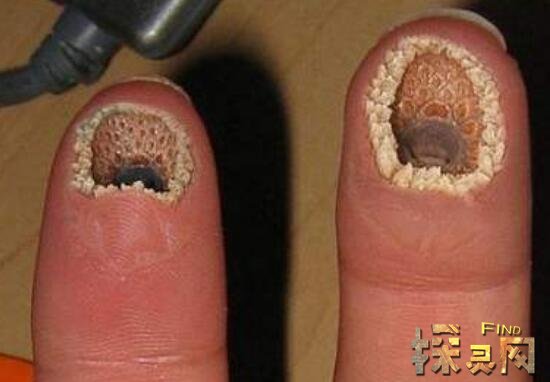 手指尖端看着就像空洞一样,让人不寒而栗,特别是有密集恐惧症的人