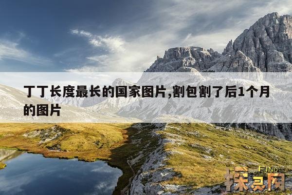 丁丁长度最长的国家图片,割包割了后1个月的图片